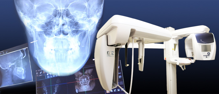歯科用ctによる撮影 診断 診療内容 歯周病治療なら川崎駅徒歩1分の歯医者 日航ビル歯科室へ