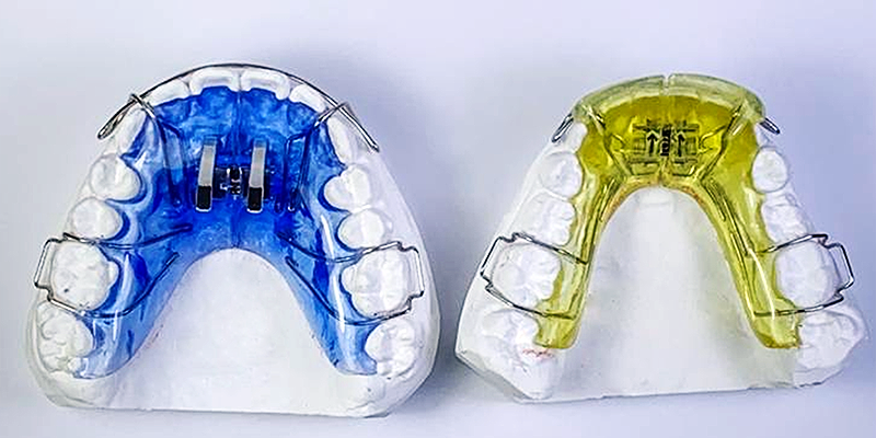 画像に alt 属性が指定されていません。ファイル名: orthodontic01.png